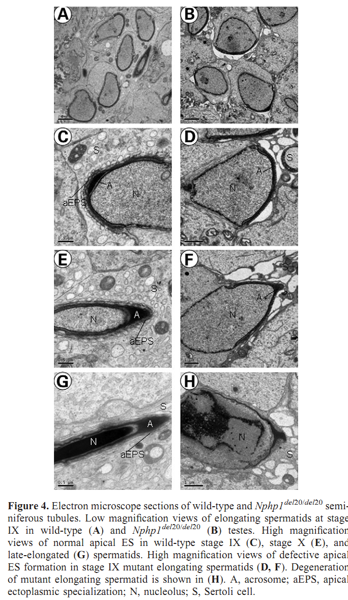 FertilityOnline | Spermatogenes