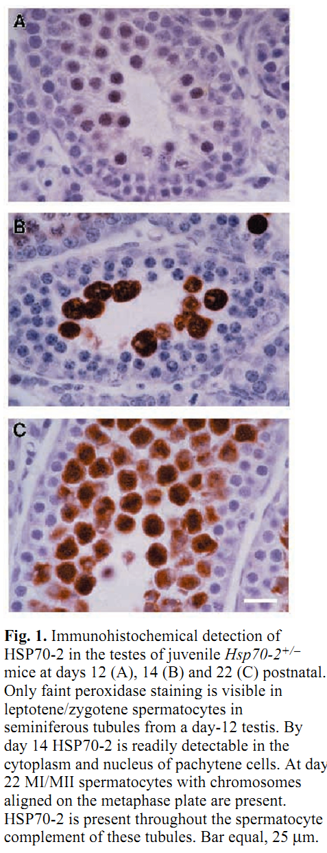 FertilityOnline | Spermatogenes